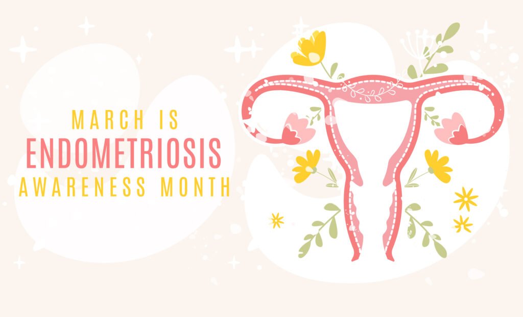 endometriozis nedir belirtileri tedavisi op dr olcay ilhan bursa